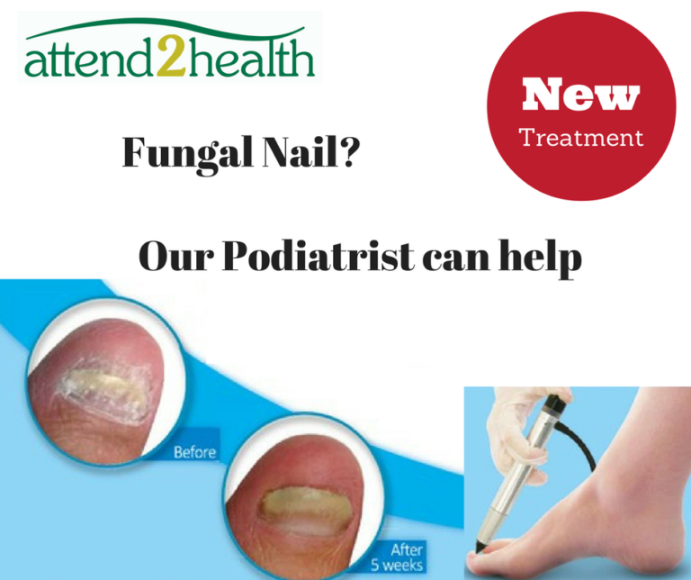 New Fungal Nail Treatment Attend2Health